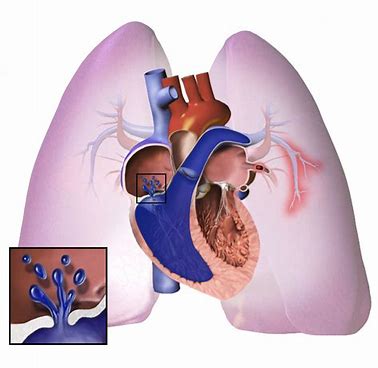 通化东宝：减肥产品研发获重要进展 GLP-1/GIP管线Ib期临床试验减重数据亮眼