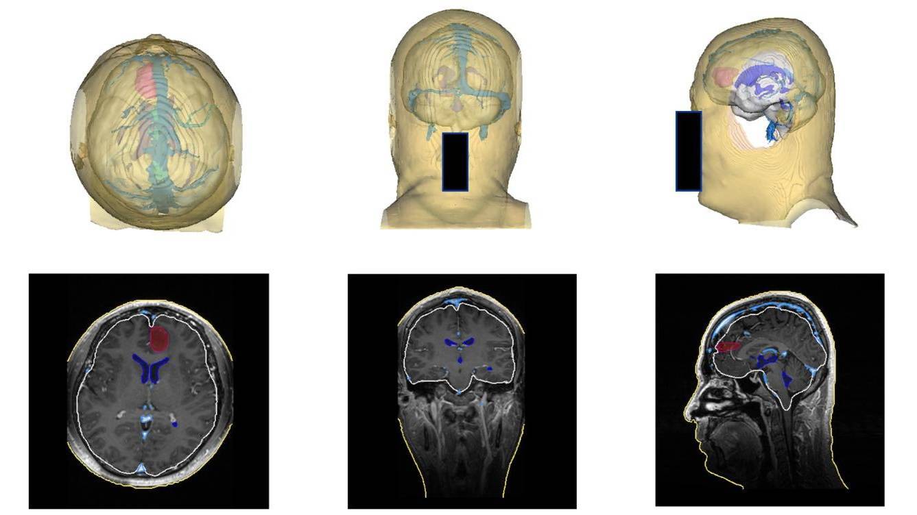 翔宇医疗：已成立Sun-BCI Lab脑机接口实验室
